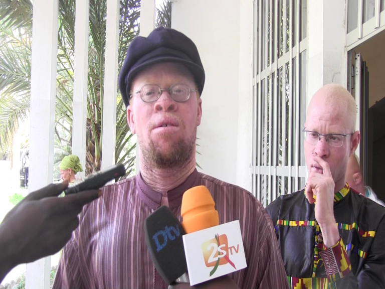 Législatives de juillet 2017, la fédération nationale des albinos du Sénégal exprime son inquiétude