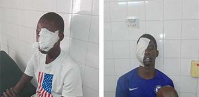 Fin du bras de fer entre enseignant et gouvernement, Bilan deux blessés graves par bavures policières