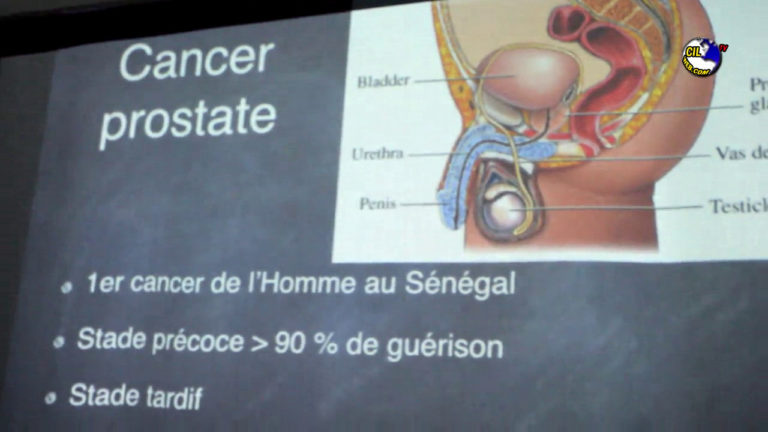 LUTTE CONTRE LE CANCER,  LE FSD/BJ INVITE L’ETAT A EN FAIRE UNE PRIORITÉ URGENTE